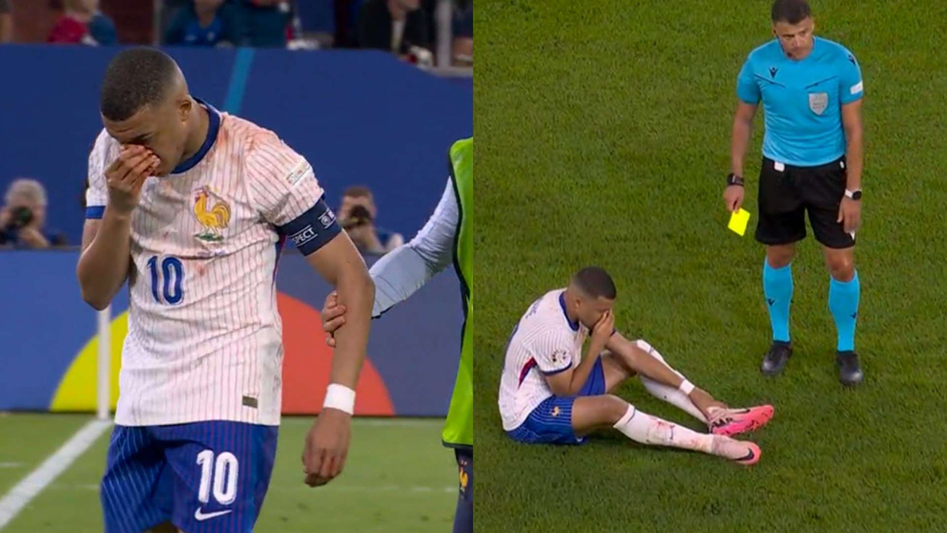 دماء مبابي ترعب جماهير ريال مدريد.. نجم فرنسا يتعرض لإصابة غريبة والحكم ينذره! | العربية Goal.com